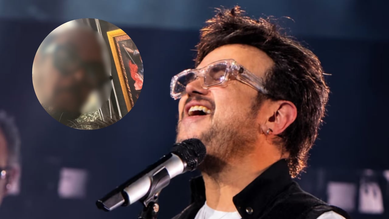 IMÁGENES FUERTES: ¿Aleks Syntek SE ARRANCÓ el cabello? Fotos preocupan a sus fans
